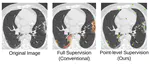 A Weakly Supervised Consistency-based Learning Method for COVID-19 Segmentation in CT Images