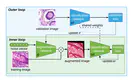 Automatic Data Augmentation Learning using Bilevel Optimization for Histopathological Images